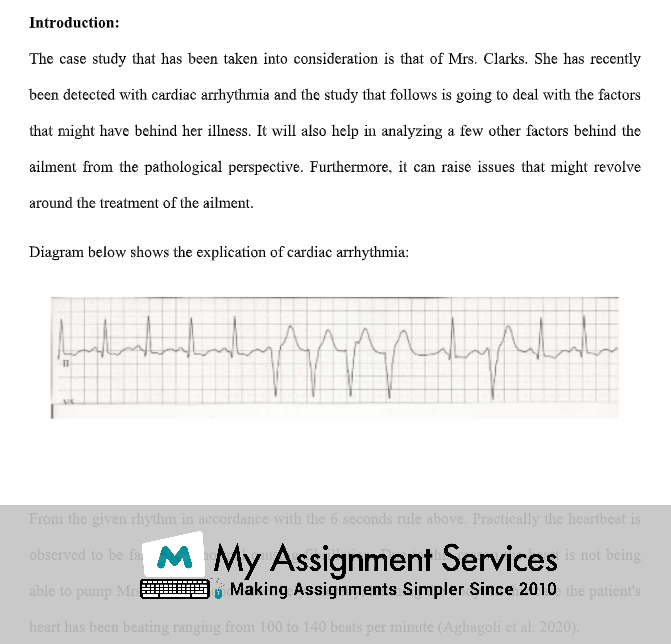 cardiac arrhythmia case study sample at my assignment services in australia